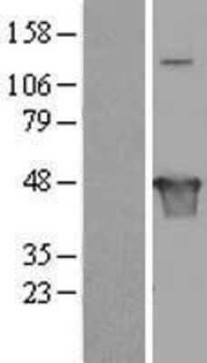 Western Blot: VAT1L Overexpression Lysate [NBL1-12269]