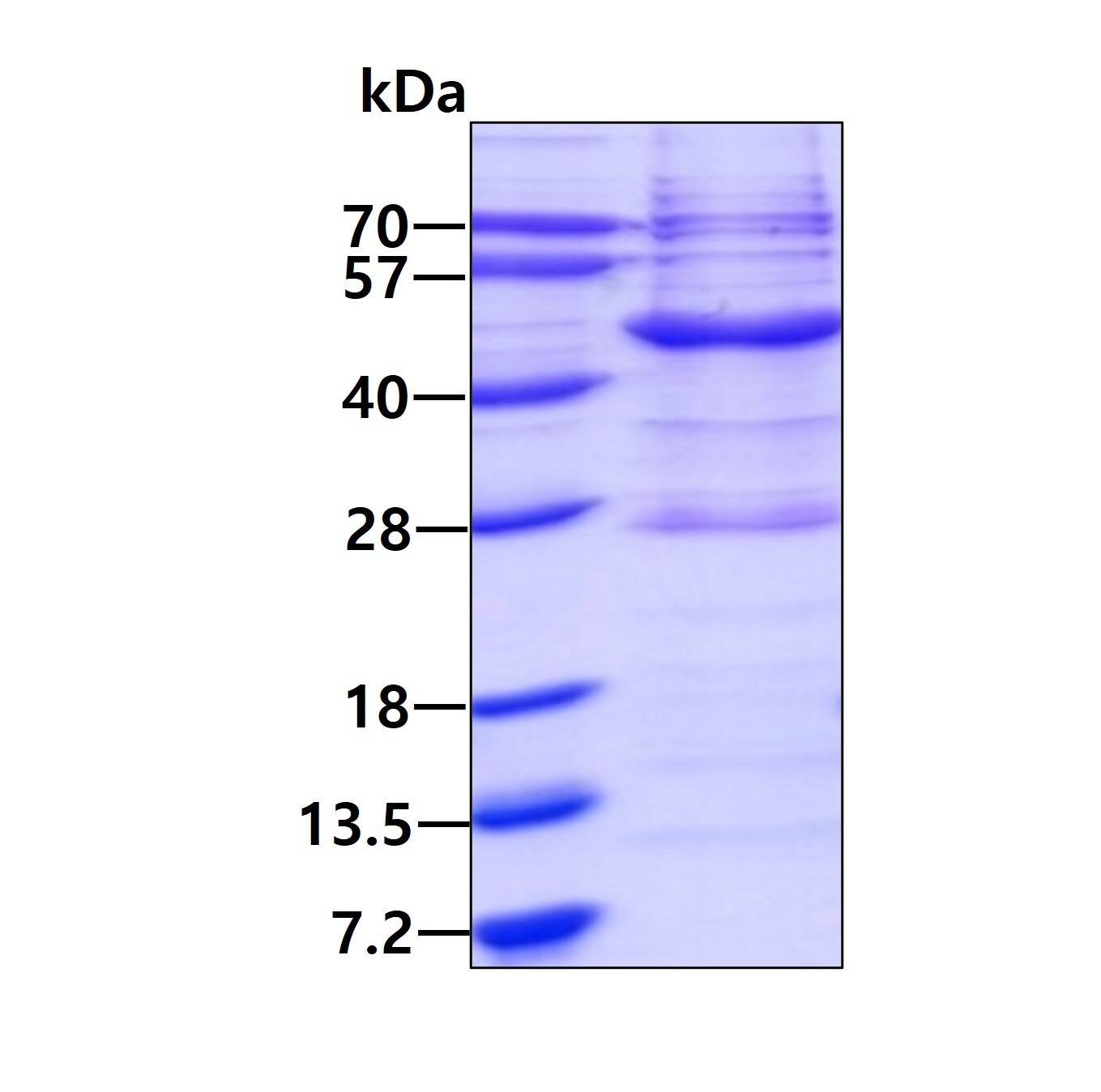 SDS-PAGE: Recombinant Human Vav-1 His Protein [NBP2-22938]