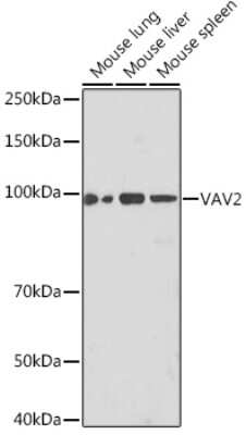 Western Blot: VAV2 Antibody (3S0O9) [NBP3-16218]