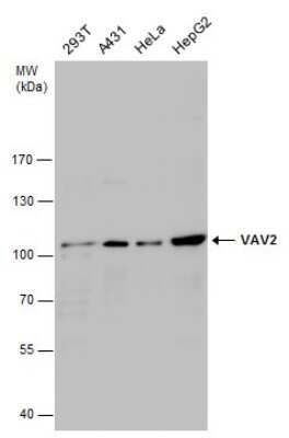 Western Blot: VAV2 Antibody [NBP3-13026]