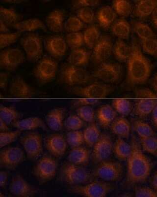 Immunocytochemistry/ Immunofluorescence: VAV3 Antibody - Azide and BSA Free [NBP2-93949]