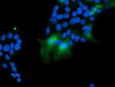 Immunocytochemistry/ Immunofluorescence: VBP1 Antibody (OTI2A3) [NBP2-03754]