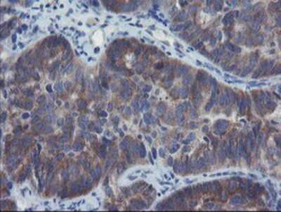 Immunohistochemistry-Paraffin: VBP1 Antibody (OTI2A3) [NBP2-03754]