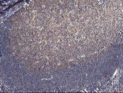 Immunohistochemistry-Paraffin: VBP1 Antibody (OTI2A3) [NBP2-03754]