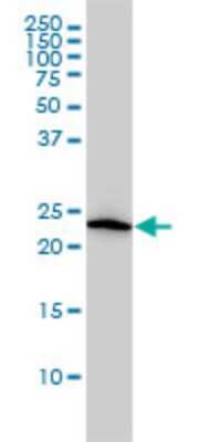 Western Blot: VBP1 Antibody (3D11) [H00007411-M01]