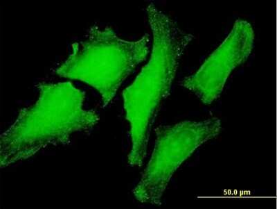 Immunocytochemistry/ Immunofluorescence: VBP1 Antibody [H00007411-B01P]