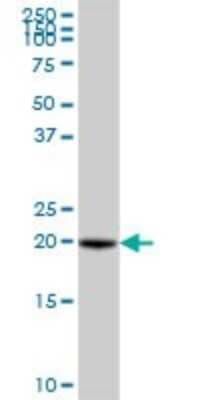 Western Blot: VBP1 Antibody [H00007411-B01P]