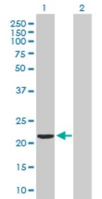 Western Blot: VBP1 Antibody [H00007411-B01P]