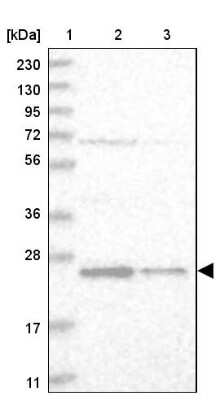 Western Blot: VBP1 Antibody [NBP1-80922]