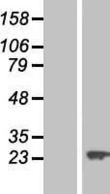 Western Blot: VBP1 Overexpression Lysate [NBL1-17704]