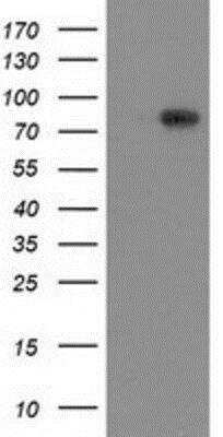 Western Blot: VCAM-1/CD106 Antibody (OTI3H10) [NBP2-03600]