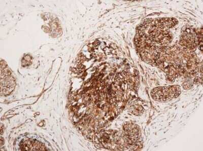Immunohistochemistry: VCAM-1/CD106 Antibody (6G9) - Azide and BSA Free [NBP2-81005]