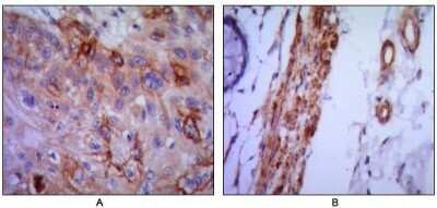 Immunohistochemistry: VCAM-1/CD106 Antibody (6G9) - Azide and BSA Free [NBP2-81005]