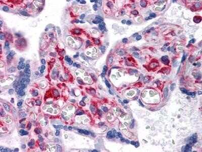 Immunohistochemistry-Paraffin: VCAM-1/CD106 Antibody (6G9) - BSA Free [NBP1-47491]