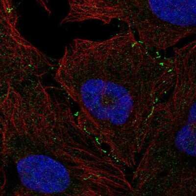 Immunocytochemistry/ Immunofluorescence: VCAM-1/CD106 Antibody [NBP2-55858]