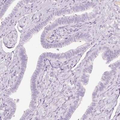 Immunohistochemistry-Paraffin: VCAM-1/CD106 Antibody [NBP2-38223]