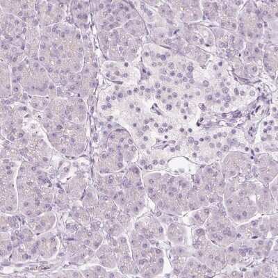Immunohistochemistry-Paraffin: VCAM-1/CD106 Antibody [NBP2-38223]
