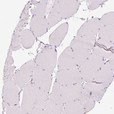Immunohistochemistry-Paraffin: VCAM-1/CD106 Antibody [NBP2-38223]