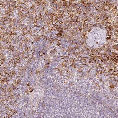 Immunohistochemistry-Paraffin: VCAM-1/CD106 Antibody [NBP2-38223]