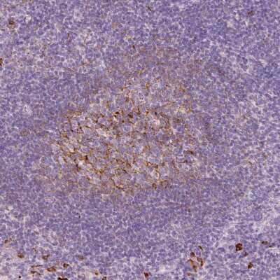 Immunohistochemistry-Paraffin: VCAM-1/CD106 Antibody [NBP2-38223]