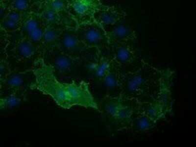 Immunocytochemistry/ Immunofluorescence: VCAM-1/CD106 Antibody (OTI3H10) - Azide and BSA Free [NBP2-74840]