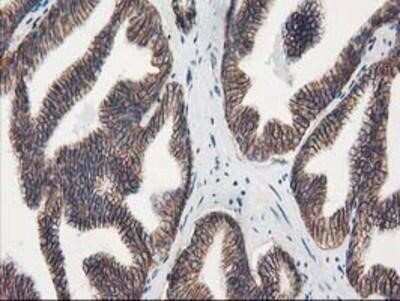 Immunohistochemistry: VCAM-1/CD106 Antibody (OTI3H10) - Azide and BSA Free [NBP2-74840]