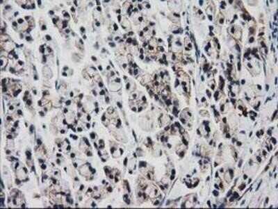 Immunohistochemistry: VCAM-1/CD106 Antibody (OTI3H10) - Azide and BSA Free [NBP2-74840]