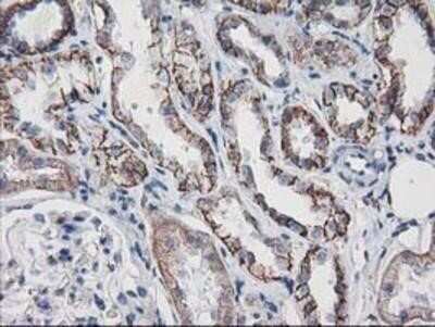 Immunohistochemistry: VCAM-1/CD106 Antibody (OTI3H10) - Azide and BSA Free [NBP2-74840]