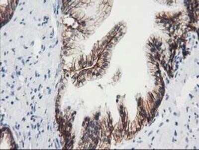 Immunohistochemistry: VCAM-1/CD106 Antibody (OTI3H10) - Azide and BSA Free [NBP2-74840]