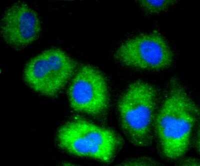 Immunocytochemistry/ Immunofluorescence: VCAM-1/CD106 Antibody (SA05-04) [NBP2-67292]