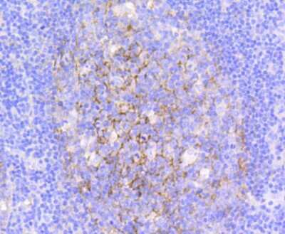 Immunohistochemistry-Paraffin: VCAM-1/CD106 Antibody (SA05-04) [NBP2-67292]