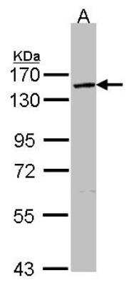 Western Blot: VCIP135/VCPIP1 Antibody [NBP1-32663]
