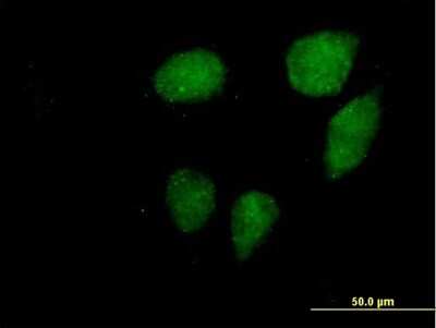 Immunocytochemistry/ Immunofluorescence: VCX3A Antibody [H00051481-B01P]