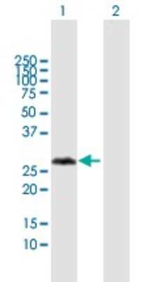 Western Blot: VCX3A Antibody [H00051481-B01P]