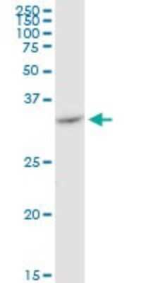 Western Blot: VDAC2 Antibody (3D2) [H00007417-M01]