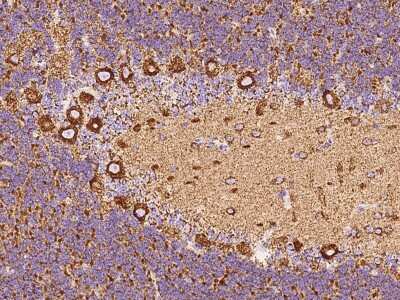 Immunohistochemistry-Paraffin: VDAC2 Antibody [NBP2-97576]