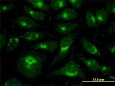 Immunocytochemistry/ Immunofluorescence: VDP p115 Antibody (3F4) [H00008615-M03]