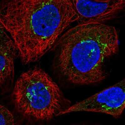 Immunocytochemistry/ Immunofluorescence: VDP p115 Antibody [NBP2-38401]