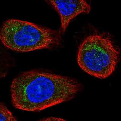 Immunocytochemistry/ Immunofluorescence: VDP p115 Antibody [NBP2-55590]