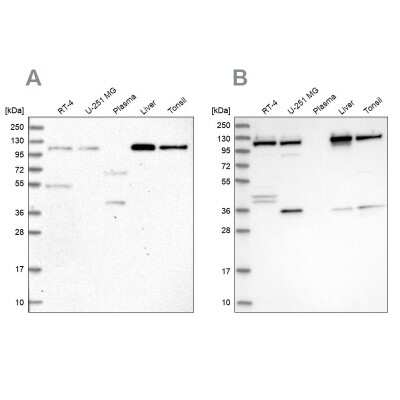 Western Blot: VDP p115 Antibody [NBP2-55590]
