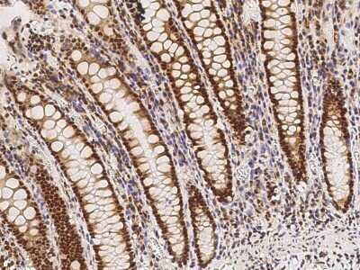 Immunohistochemistry-Paraffin: VDR/NR1I1/Vitamin D Receptor Antibody [NBP2-98841]