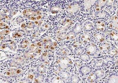 Immunohistochemistry-Paraffin: VE-Cadherin Antibody (012) [NBP2-89497]