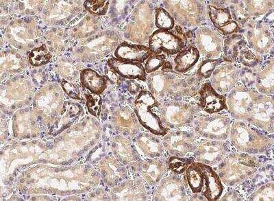 Immunohistochemistry-Paraffin: VE-Cadherin Antibody (012) [NBP2-89497]