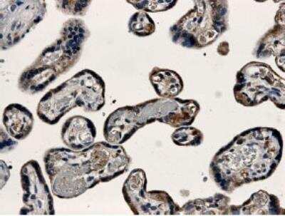 Immunohistochemistry-Paraffin: VE-Cadherin Antibody (MM0012-8A03) - Azide and BSA Free [NB110-60978]