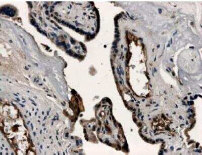 Immunohistochemistry-Paraffin: VE-Cadherin Antibody (MM0012-8A03) - Azide and BSA Free [NB110-60978]