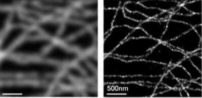 Immunofluorescence: VECTASHIELD(R) Antifade Mounting Medium [H-1000-NB]