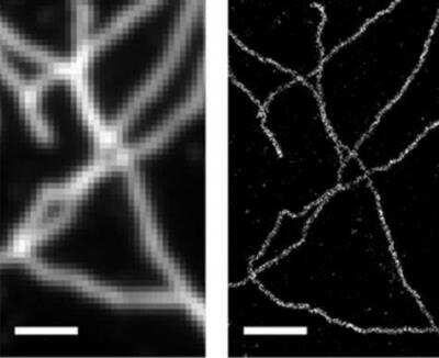 Immunofluorescence: VECTASHIELD(R) Antifade Mounting Medium [H-1000-NB]