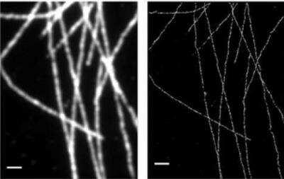 Immunofluorescence: VECTASHIELD(R) Antifade Mounting Medium [H-1000-NB]