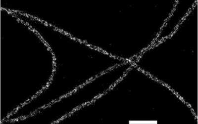 Immunofluorescence: VECTASHIELD(R) Antifade Mounting Medium [H-1000-NB]