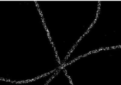 Immunofluorescence: VECTASHIELD(R) Antifade Mounting Medium [H-1000-NB]